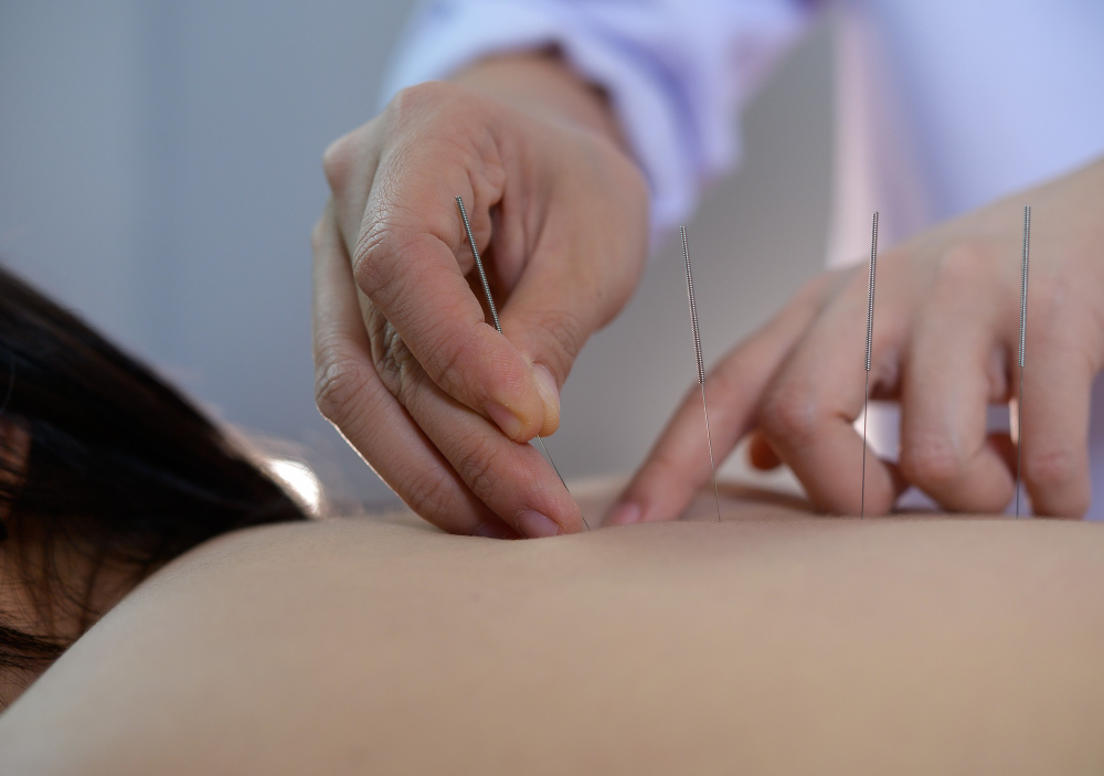 O acupunturista é o profissional que realiza a prática da acupuntura. Trata-se de um terapeuta com profundo conhecimento em Medicina Tradicional Chinesa
